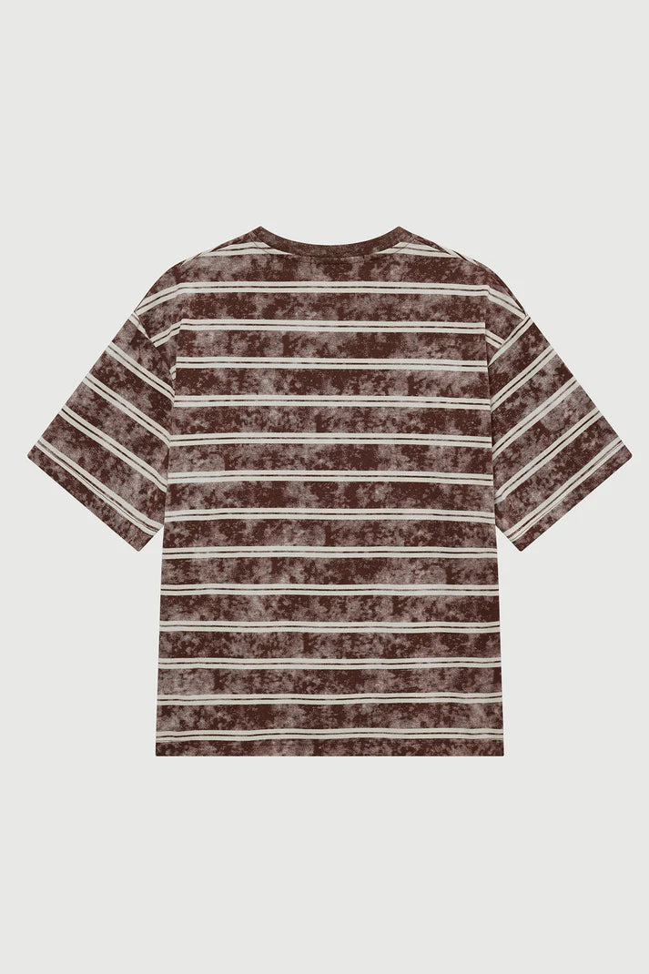 ACUPUNCTURE ACID STRIPES T-SHIRT
